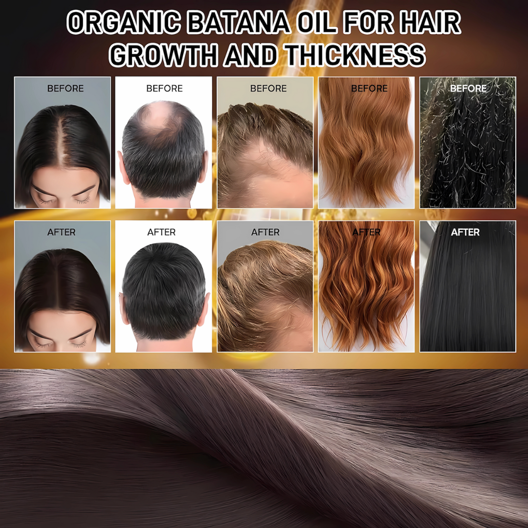 310Roots BotanX™ Organic Batana Oil